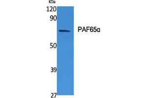Image no. 2 for anti-TAF6-Like RNA Polymerase II, P300/CBP-Associated Factor (PCAF)-Associated Factor, 65kDa (TAF6L) (N-Term) antibody (ABIN3186308)