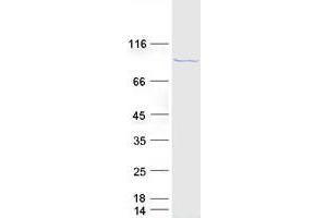 Image no. 1 for DEAD (Asp-Glu-Ala-Asp) Box Polypeptide 21 (DDX21) protein (Myc-DYKDDDDK Tag) (ABIN2719279)