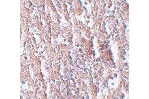 Immunohistochemistry (IHC) image for anti-Solute Carrier Family 39 (Metal Ion Transporter), Member 5 (SLC39A5) (Middle Region) antibody (ABIN1031181)