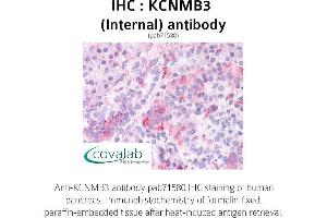 Image no. 1 for anti-Potassium Large Conductance Calcium-Activated Channel, Subfamily M beta Member 3 (KCNMB3) (Internal Region) antibody (ABIN1736192)