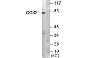 Image no. 2 for anti-Prostaglandin-Endoperoxide Synthase 2 (Prostaglandin G/H Synthase and Cyclooxygenase) (PTGS2) (AA 555-604) antibody (ABIN2889179)