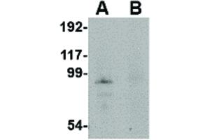 Image no. 1 for anti-Junctophilin 4 (JPH4) (Internal Region) antibody (ABIN6656242)