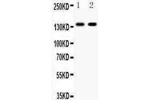 Image no. 2 for anti-Cadherin 1, Type 1, E-Cadherin (Epithelial) (CDH1) (AA 286-703) antibody (ABIN3043808)