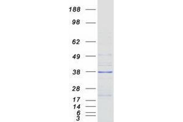 Vacuolar Protein Sorting 37 Homolog B (VPS37B) protein (Myc-DYKDDDDK Tag)