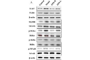 Image no. 1 for anti-Nuclear Factor of kappa Light Polypeptide Gene Enhancer in B-Cells Inhibitor, alpha (NFKBIA) (AA 1-120) antibody (ABIN674454)