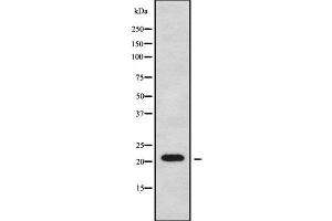 Image no. 2 for anti-Cancer/testis Antigen 2 (CTAG2) (Internal Region) antibody (ABIN6261074)