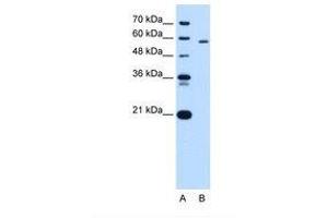 Image no. 2 for anti-Pyruvate Kinase, Liver and RBC (PKLR) (AA 56-105) antibody (ABIN320669)