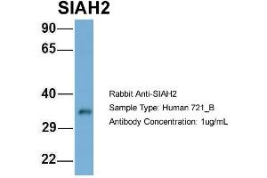 anti-Siah E3 Ubiquitin Protein Ligase 2 (SIAH2) (Middle Region) antibody