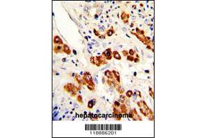 Immunohistochemistry (IHC) image for anti-Carcinoembryonic Antigen-Related Cell Adhesion Molecule 1 (Biliary Glycoprotein) (CEACAM1) antibody (ABIN2158199)