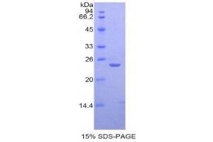 Image no. 1 for Sialic Acid Binding Ig-Like Lectin 12 (SIGLEC12) (AA 22-218) protein (His tag) (ABIN1877978)