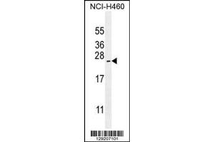 Image no. 3 for anti-ADP-Ribosylation Factor-Like 17A (ARL17A) (Center) antibody (ABIN2159252)
