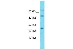Image no. 1 for anti-Mitochondrial Ribosomal Protein L22 (MRPL22) (Middle Region) antibody (ABIN2789277)