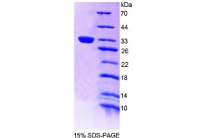 Image no. 1 for Tec Protein Tyrosine Kinase (TEC) (AA 370-623) protein (His tag) (ABIN6239124)