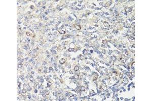 Immunohistochemistry of paraffin-embedded Human tonsil using MUL1 Polyclonal Antibody at dilution of 1:100 (40x lens).