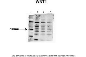 Image no. 2 for anti-Wingless-Type MMTV Integration Site Family, Member 1 (WNT1) (Middle Region) antibody (ABIN2779465)