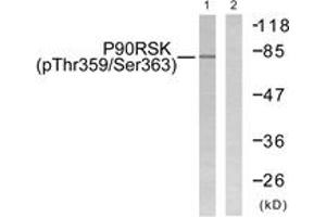 Image no. 1 for anti-Ribosomal Protein S6 Kinase, 90kDa, Polypeptide 3 (RPS6KA3) (AA 331-380), (pThr359) antibody (ABIN1531362)
