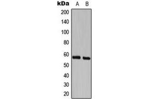 Image no. 2 for anti-CDK5 Regulatory Subunit Associated Protein 3 (CDK5RAP3) (Center) antibody (ABIN2705844)