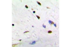 Image no. 1 for anti-Activity-Dependent Neuroprotector Homeobox (ADNP) (N-Term) antibody (ABIN3222810)