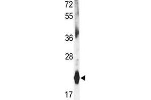 Image no. 3 for anti-Dihydrofolate Reductase (DHFR) (AA 135-164) antibody (ABIN3030729)