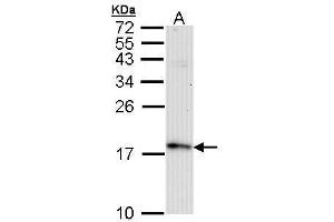 Image no. 8 for anti-Fission 1 (FIS1) (full length) antibody (ABIN2856782)