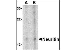 Image no. 3 for anti-Neuritin 1 (NRN1) (Center) antibody (ABIN500332)