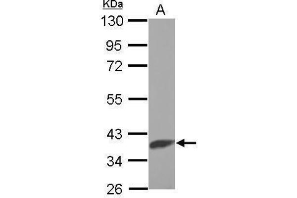 anti-Solute Carrier Family 25 (Mitochondrial Carrier, Citrate Transporter), Member 1 (Slc25a1) (Center) antibody