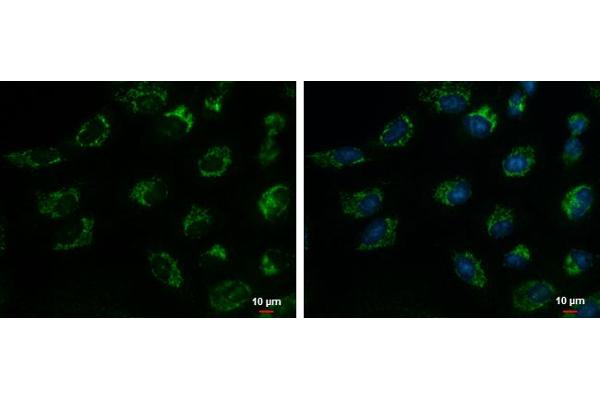 anti-Translocase of Inner Mitochondrial Membrane 17 Homolog A (TIMM17A) (C-Term) antibody