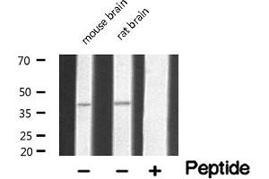 Image no. 1 for anti-Serotonin Receptor 5A (HTR5A) (Internal Region) antibody (ABIN6259653)