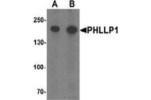 Image no. 1 for anti-PH Domain and Leucine Rich Repeat Protein Phosphatase 1 (PHLPP1) (N-Term) antibody (ABIN1449987)