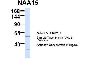 Image no. 1 for anti-N(alpha)-Acetyltransferase 15, NatA Auxiliary Subunit (NAA15) (N-Term) antibody (ABIN2783595)