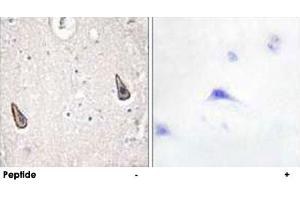 Image no. 1 for anti-Adenylate Cyclase 5 (ADCY5) antibody (ABIN5572035)