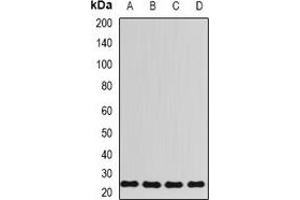 Image no. 2 for anti-Ribosomal Protein L13 (RPL13) antibody (ABIN2966998)