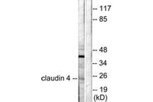 Image no. 1 for anti-Claudin 4 (CLDN4) (AA 160-209) antibody (ABIN1533223)
