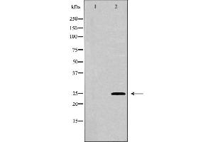 Image no. 1 for anti-Adenylate Kinase 4 (AK4) (Internal Region) antibody (ABIN6259847)