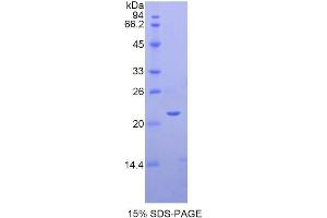 Image no. 1 for Sema Domain, Immunoglobulin Domain (Ig), Short Basic Domain, Secreted, (Semaphorin) 3F (SEMA3F) (AA 350-483) protein (His tag) (ABIN1878505)