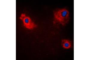 Image no. 1 for anti-TRAF Family Member-Associated NFKB Activator (TANK) (Center) antibody (ABIN2707137)