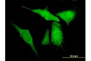 Immunofluorescence of purified MaxPab antibody to KCNIP4 on HeLa cell.