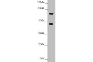 SLC39A4 anticorps  (AA 23-327)