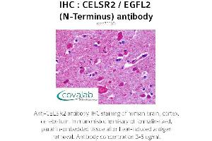 Image no. 2 for anti-Cadherin EGF LAG Seven Pass G-Type Receptor 2 (CELSR2) (Extracellular Domain), (N-Term) antibody (ABIN1732970)