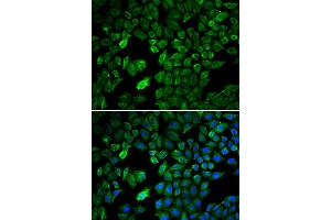 Image no. 1 for anti-Protein Arginine Methyltransferase 5 (PRMT5) antibody (ABIN6568604)