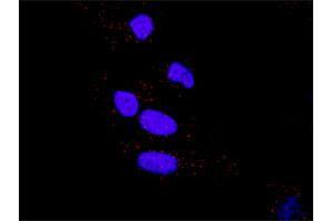Image no. 1 for HSPB1 & F13A1 Protein Protein Interaction Antibody Pair (ABIN1339786)