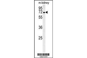 Image no. 1 for anti-Glucosamine (UDP-N-Acetyl)-2-Epimerase/N-Acetylmannosamine Kinase (GNE) (AA 580-607), (C-Term) antibody (ABIN651511)