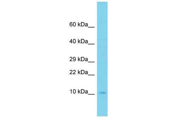 UBE2D4 抗体  (C-Term)