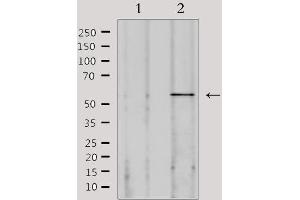 Image no. 3 for anti-Sperm Adhesion Molecule 1 (PH-20 Hyaluronidase, Zona Pellucida Binding) (SPAM1) (Internal Region) antibody (ABIN6265252)