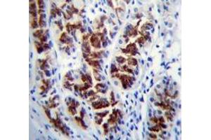 Immunohistochemistry analysis in human stomach tissue (Formalin-fixed, Paraffin-embedded) using PTPN20  Antibody , followed by peroxidase conjugated secondary antibody and DAB staining.