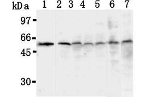 Image no. 1 for anti-Thioredoxin Interacting Protein (TXNIP) antibody (ABIN567793)