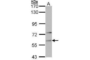 Image no. 2 for anti-Phenylalanyl-tRNA Synthetase, alpha Subunit (FARSA) (Internal Region) antibody (ABIN2855995)