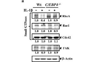 C/EBPδ represses RhoA expression and contributes to attenuated migration of IL-1β-treated astrocytes.