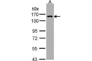 Image no. 1 for anti-LIM and Calponin Homology Domains 1 (LIMCH1) (C-Term) antibody (ABIN2856627)
