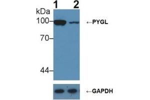 Image no. 3 for phosphorylase, Glycogen, Liver (PYGL) ELISA Kit (ABIN6574226)